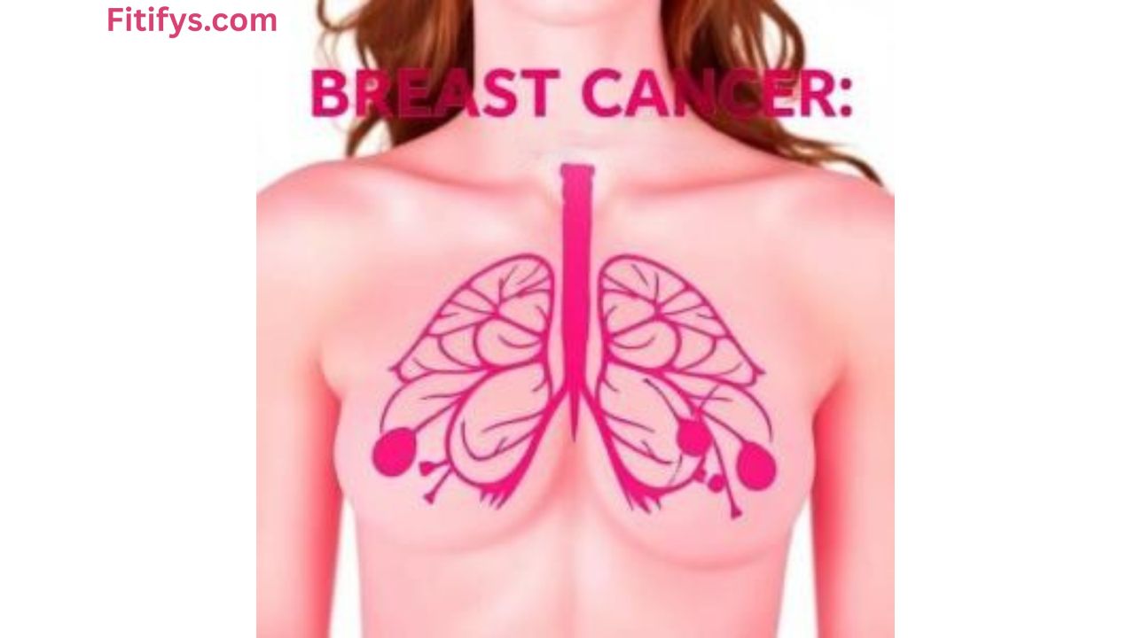 Illustration of a topless female torso showing a stylized anatomical diagram of breast tissue and lymphatic system in pink, representing breast cancer awareness. The image includes the title “BREAST CANCER:” at the top in bold pink letters and the website name “Fitifys.com” in the top-left corner.